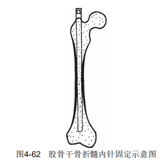 4-62.png