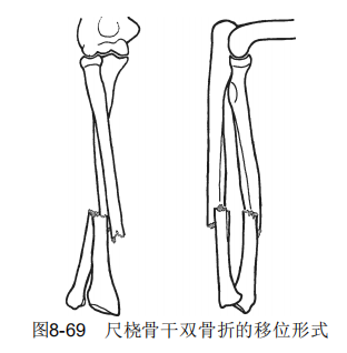 8-69.png