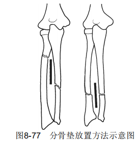 8-77png.png