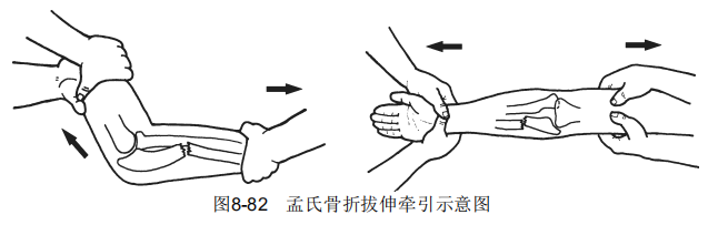 8-82.png