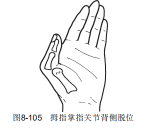 105.png