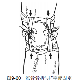 9-60.png
